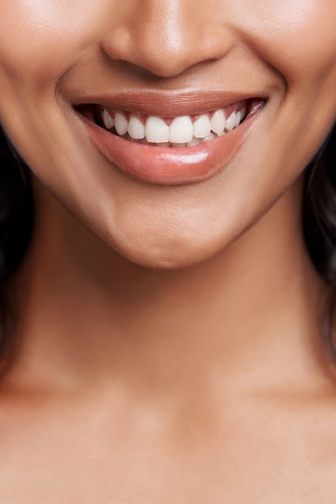 Close-up of a flawless, bright smile showing the results of cosmetic work at Clearly Dental Riverwood.